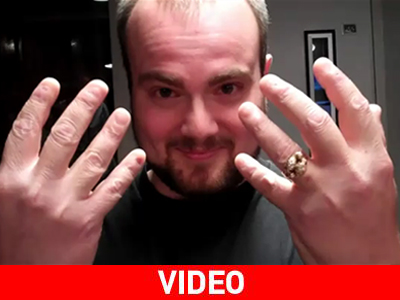 Ο άνθρωπος που δεν έχει νύχια